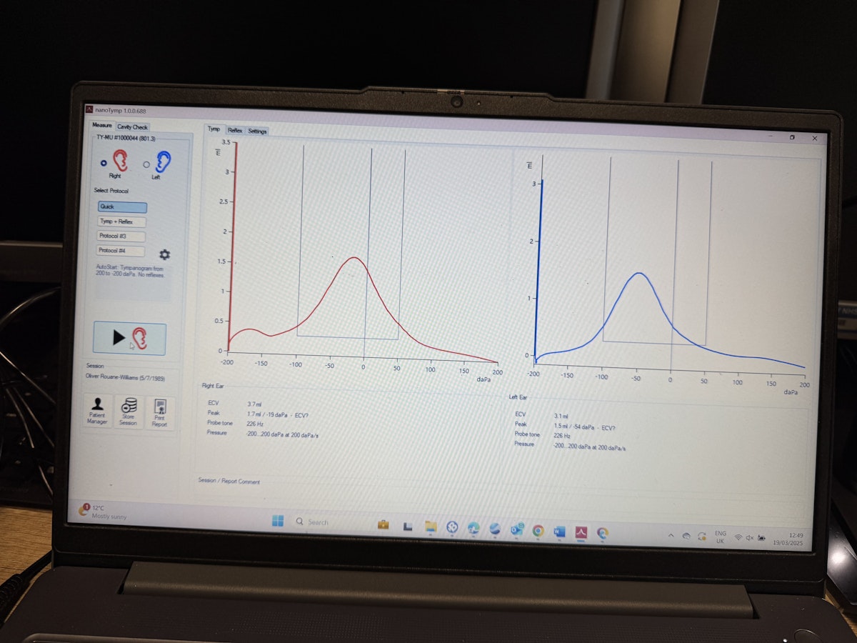 My air and bone conduction testing results